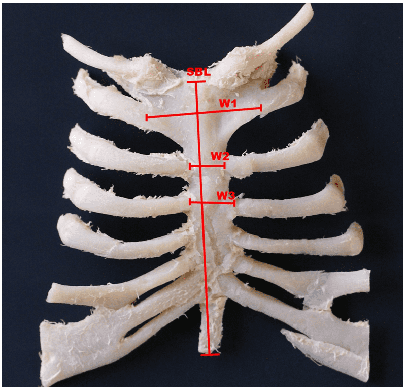 PDF] Computed Tomography Measurement of Rib Cage Morphometry in